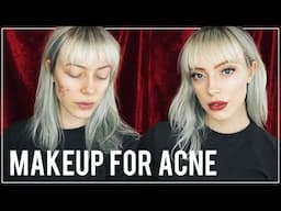 How To Cover Pimples with ACNE SAFE MAKEUP PRODUCTS