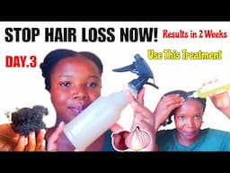 DAY 3: REDUCE HAIR BREAKAGE & BOOST HAIR GROWTH FAST | 14 - Day Onion Hair Growth Challenge