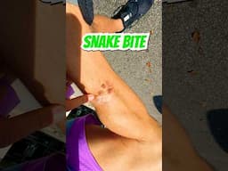 I Got BIT by a VENOMOUS SNAKE!! (GROSS)