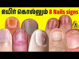 8 dangerous nail sign| உங்க விரல் நகம் நல்லா இருக்கா? Nail signs of Disease