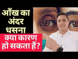 आंखे अंदर क्यों धसती है || आंखे अंदर धसने के कारण || Sunken eyes cause and treatment