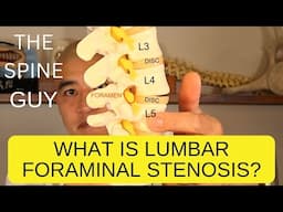 What is Lumbar Foraminal Stenosis?