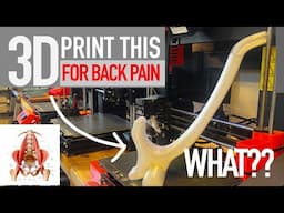 How 3D Printing removed my back pain