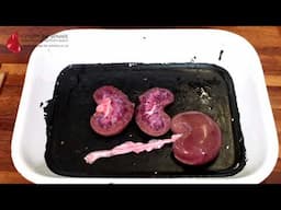 Kidney Excretory System Dissection GCSE A Level Biology NEET Practical Skills