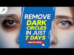 No More Undereye Bags |  Home Remedies For Dark Circles | Fitistan – Ek Fit Bharat​