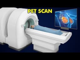 How PET scan works: 3d animation