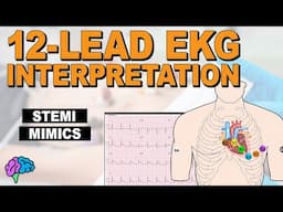 HOW-TO Recognize STEMI Mimics on 12-Lead EKG!