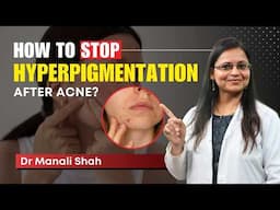 Post-Acne Hyperpigmentation: Causes & Effective Treatments Explained! | Clear Skin Clinic, Pune