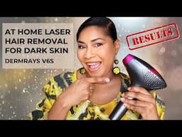 Say GOODBYE to Unwanted Hair with Dermrays V6S Laser Hair Removal!