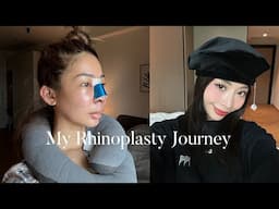 MY RHINOPLASTY JOURNEY 👃🏼✨