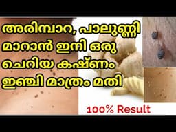 100% Effective അരിമ്പാറ വേരോടെ മാറും#arimpara removal malayalam//how to remove skin tags malayalam