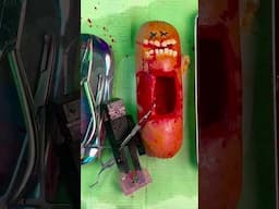 Food Surgery but every patient dies 😭💔🪦😓 Emergency #FruitSurgery #FoodSurgery #DiscountDentist