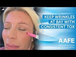 Keep Wrinkles At Bay With Consistent Tox