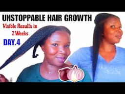 DAY 4: UNSTOPPABLE HAIR GROWTH WITH ONION JUICE & OIL | Proven Results in 14 Days!