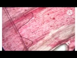 Observation of onion root tip