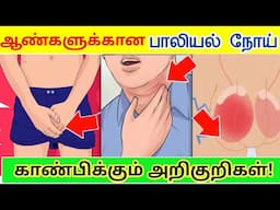 ஆண்களுக்கான பாலியல் நோய் அறிகுறிகள்/AIDS symptoms in Tamil/AIDS in Tamil/hiv explained in tamil