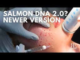 SALMON DNA 2.0? REJURAN Newer Version! NO PAIN? in Korea | Renovo Skin Clinic #SkinTreatment