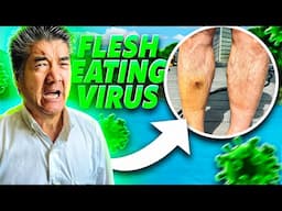 My Dad got a FLESH EATING VIRUS while River Fishing!! (WATCH TO THE END)