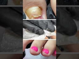 woooow😱😱😱😱😱#pedicure #nailtutorial #naildesigns #shortvideo #shorts