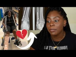 I broke my ankle on my  birthday (SURGERY & RECOVERY STORY) *Warning Graphic*