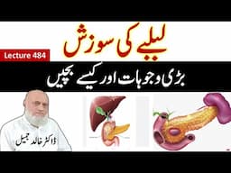 Inflammation of pancreas ! How to protect  | lecture 484