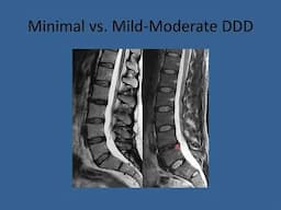 How to read an MRI | MRI image Interpretation