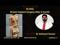 Breast implant ke 1 mahine ka patient experience