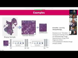 Artificial Intelligence in Medical Imaging