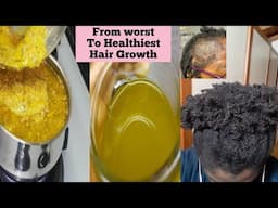 Stop hair loss fall and baldness fast before it turns chronic Alopecia