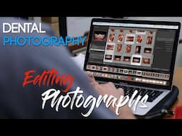 Dental Photography Basics - Editing Dental Photos