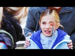 A fishhook hanging from her eyelid !!! #911 #chicagofire #firefighter