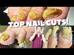 Top Extreme Nail Cutting Moments! | Compilation for Oddly Satisfying Fans