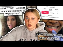 VENEER TECH BOSS-BABES FINALLY GETTING SUED!