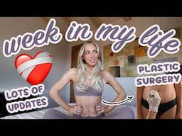 Plastic Surgery, Secret Lives of Mormon Wives, and Pick my Next Car | Week in my LIfe