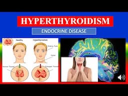 HYPERTHYROIDISM - Definition, types, causes, pathophysiology, signs & symptoms, medicine