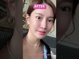 BANOBAGI Real Model: Face Contouring by Dr. Oh Changhyun🔥