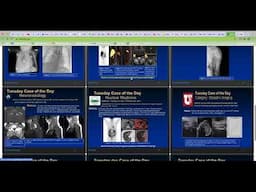 Virtual RSNA 2020: How to view lectures, educational exhibits and cases of the day