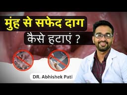 HOW TO CLEAR  WHITE PATCH FROM MOUTH | मुंह से सफेद दाग कैसे निकालें