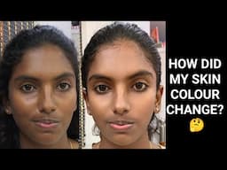 HOW DID MY SKIN COLOUR CHANGE? 🤔