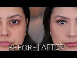 How To Achieve Flawless Skin and A Bright Under Eye | For Dark Circles