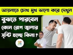 নিজের চোখ মুখে এই লক্ষণ দেখলেই বুঝতে পারবেন কোন রোগ বাসা বেঁধেছে কিনা।Certain symptoms on your face.