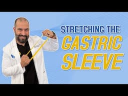 Can Your Stomach Stretch After a Gastric Sleeve? | Endobariatric | Gastric Sleeve | Dr. Alvarez