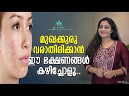 മുഖക്കുരു വരാതിരിക്കാൻ Get Rid of Pimples & Acne Permanently |Foods You Should Eat & Avoid for Acne