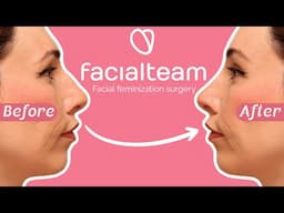 I'm having my FACE done! - [Facial feminization surgery with FACIAL TEAM]