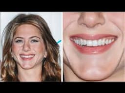 This Is What Your Teeth Shape Says About Your Personality!