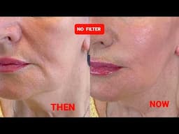 AMAZING LIFTING Massage | Sagging jowls | Nasolabial folds | Marionette lines | Double chin