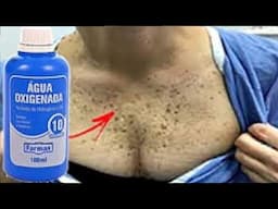 AGUA OXIGENADA TIRA RUGA DE 70 ANOS, MANCHAS, REJUVENESCE ROSTO, PASSA E DORME!😱