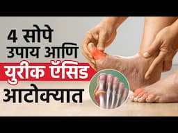 वाढलेलं युरिक अॅसिड आटोक्यात आणण्याच्या ४ सोपे उपाय | Remedies To Control High Uric Acid | SI2