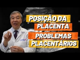 Posição da placenta muda alguma coisa?