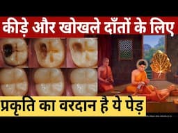 सड़े गले दांतों को ठीक कैसे करे | Home Remedies to cure tooth cavity and infection